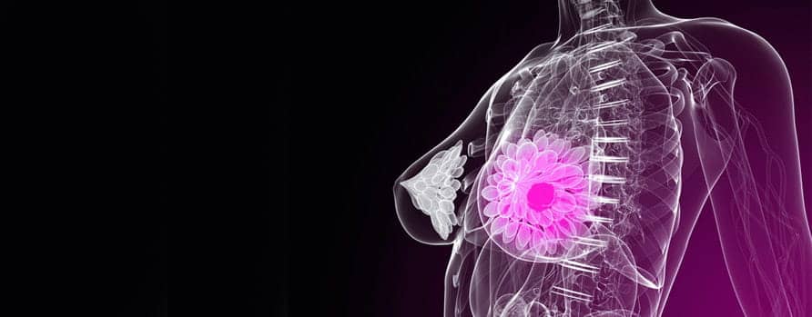 Kontrastlı Mamografi Nedir? 
