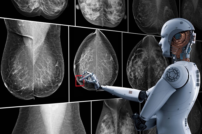 yapay-zeka-ve-mamografi-3u365.jpg