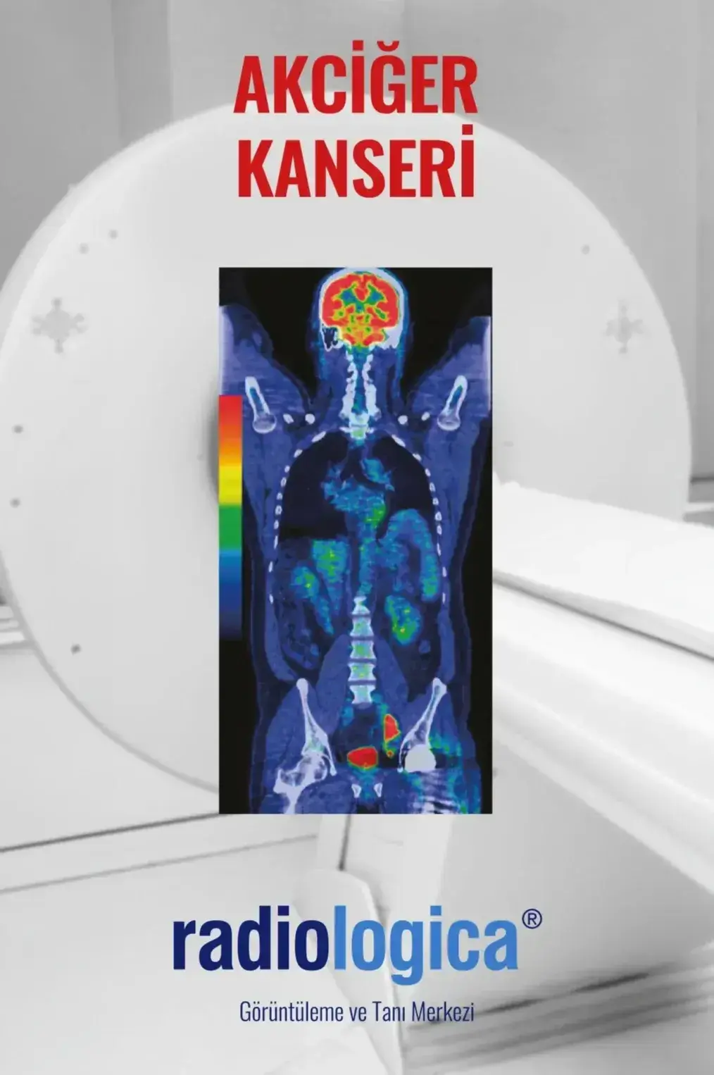 Akciğer Kanseri Taraması