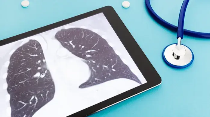 Akciğer Kanseri Taraması, Erken Tanı Hayat Kurtarır 15 yıldan uzun süredir sigara mı içiyorsunuz? Akciğer kanseri henüz belirti vermeden teşhis edilebilir. Düşük doz toraks bilgisayarlı tomografi ile erken tanı rehberimizi inceleyin.