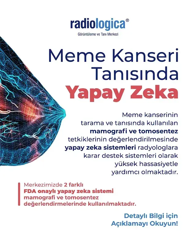 Instagram görseli