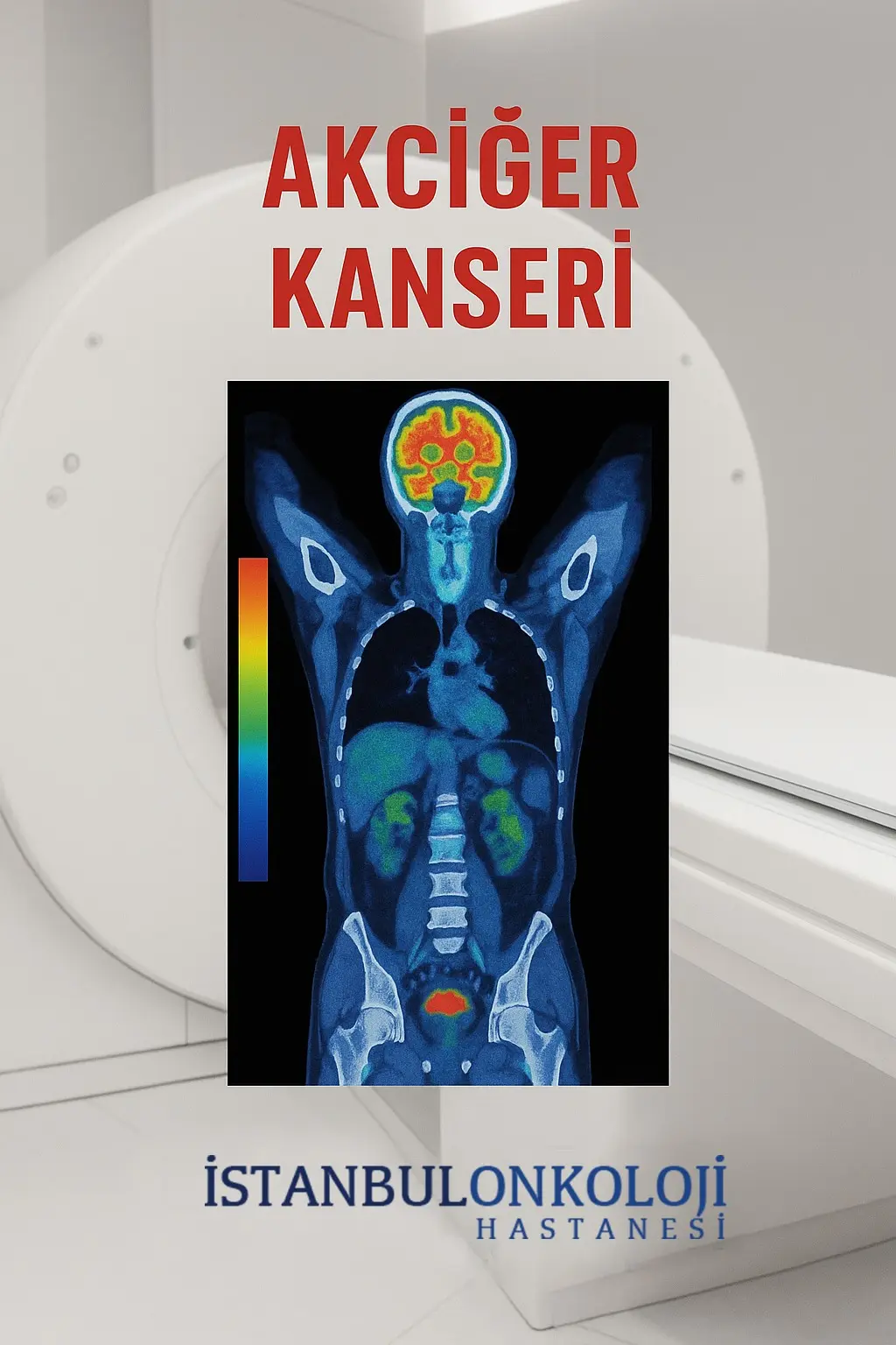 Akciğer Kanseri