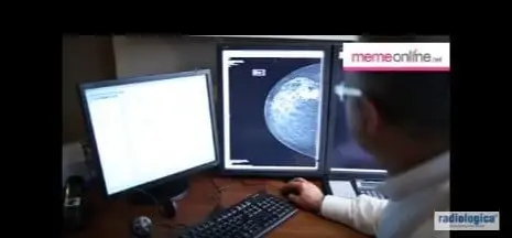 Kimler Mamografi Yaptırmamalıdır?