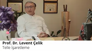 Telle İşaretleme